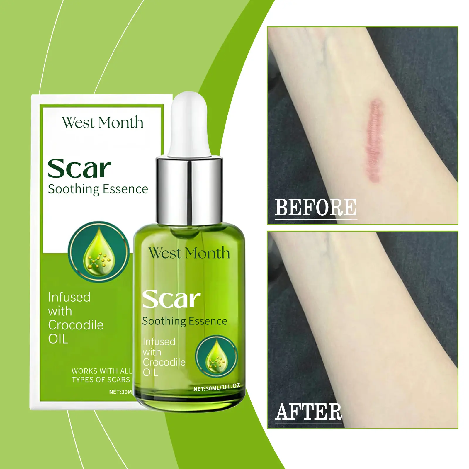 The Serum That Saved My Post-Winter Skin (And My Wallet) 2 Close-up of serum droplet from West&Month Skin Repair Essence dropper