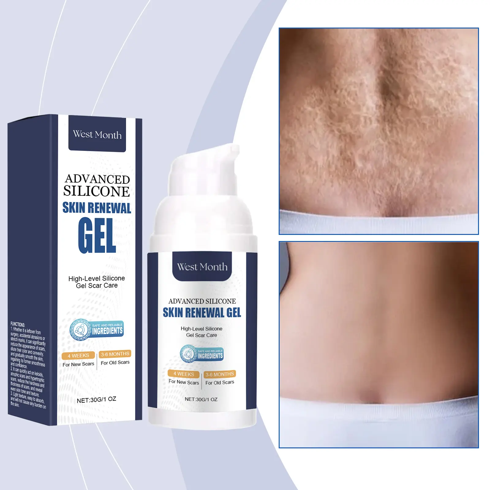 Skin Repair Gel with Vitamin E and Retinol - West&Month 2 skin repair gel nourish naturally shine West Month 293 4812