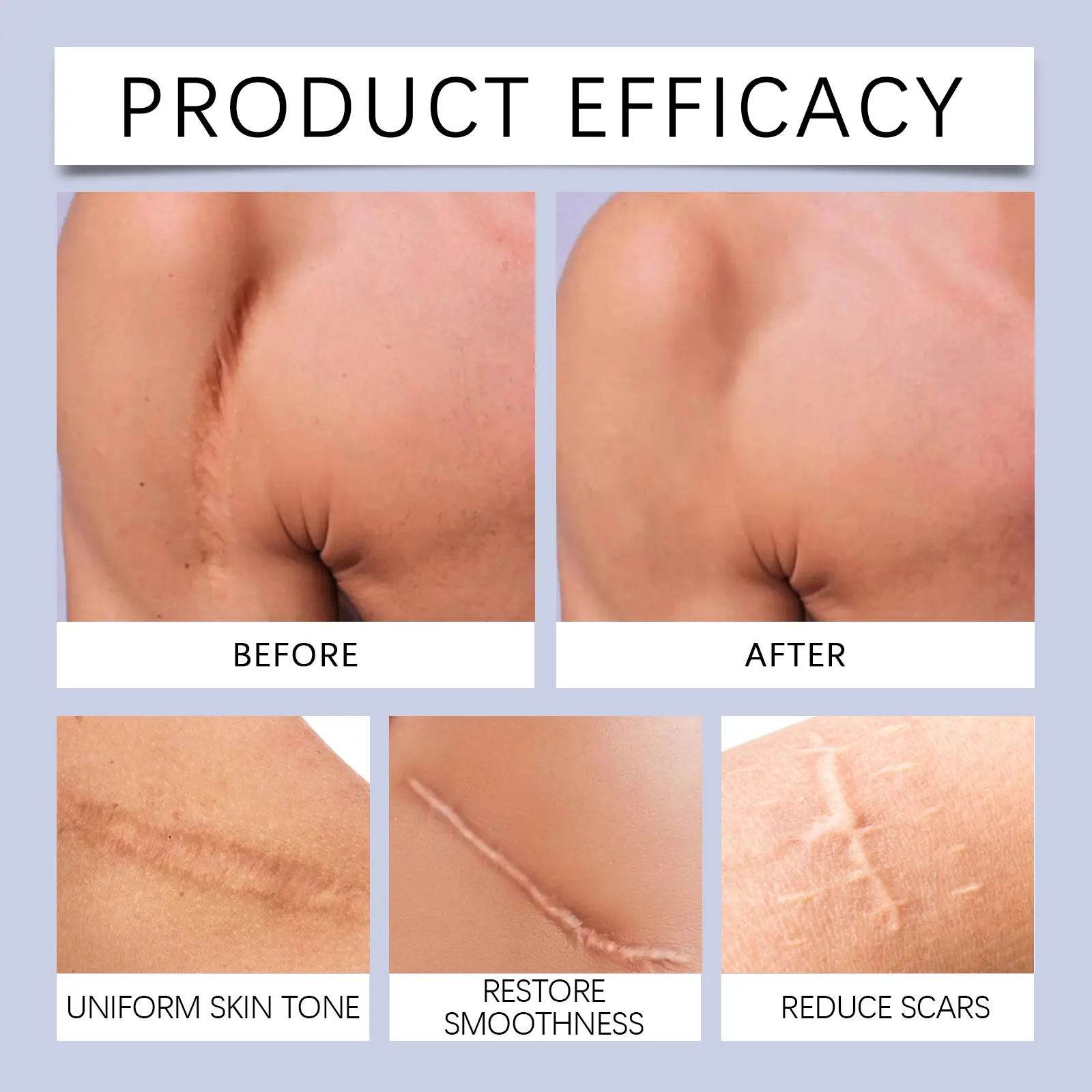 Skin Repair Gel with Vitamin E and Retinol - West&Month 9 skin repair gel nourish naturally shine West Month 293 4819