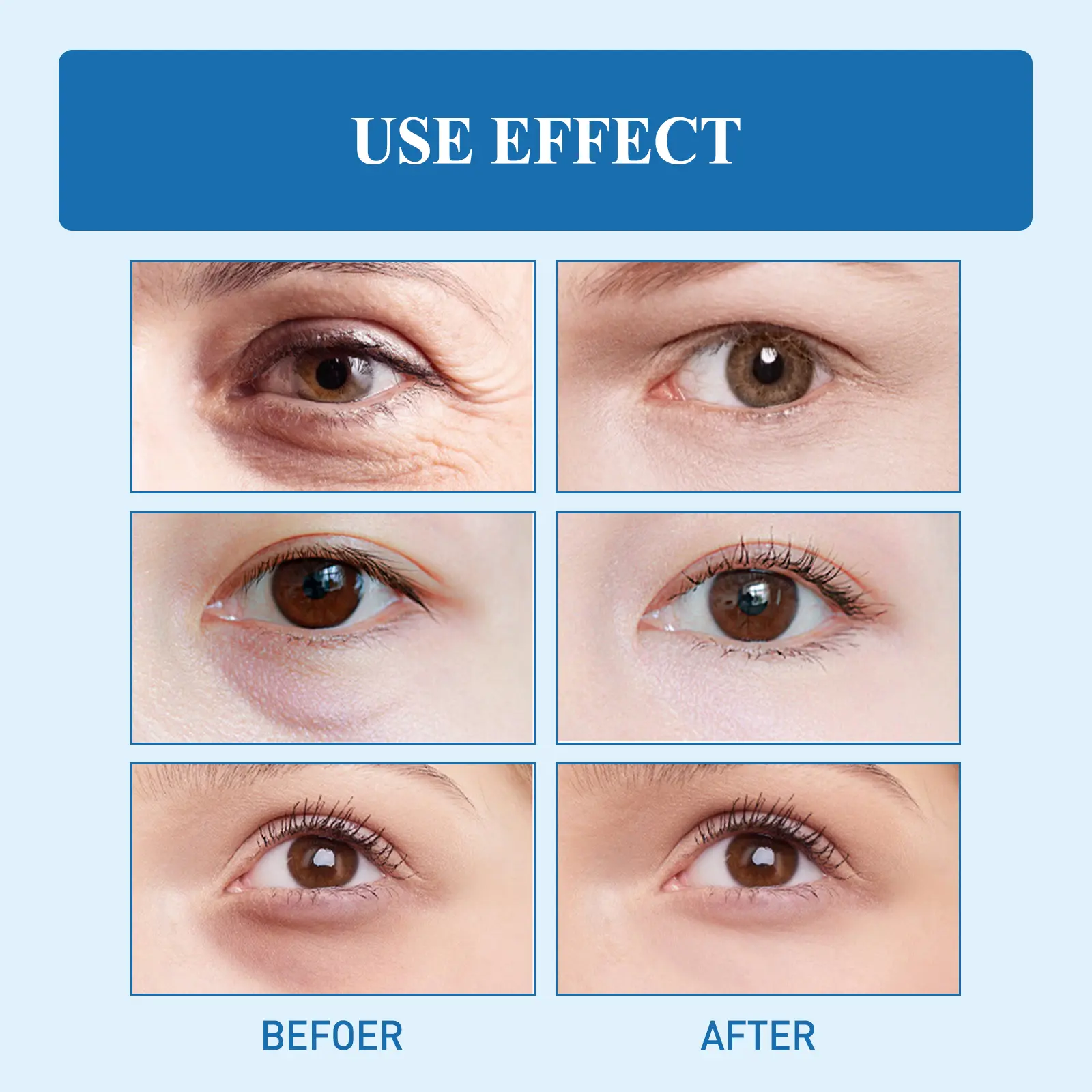 Snake Venom Peptide Eye Cream for Moisturizing & Tightening - West&Month 10 snake venom eye cream moisturize tighten eye skin West Month 418 6501