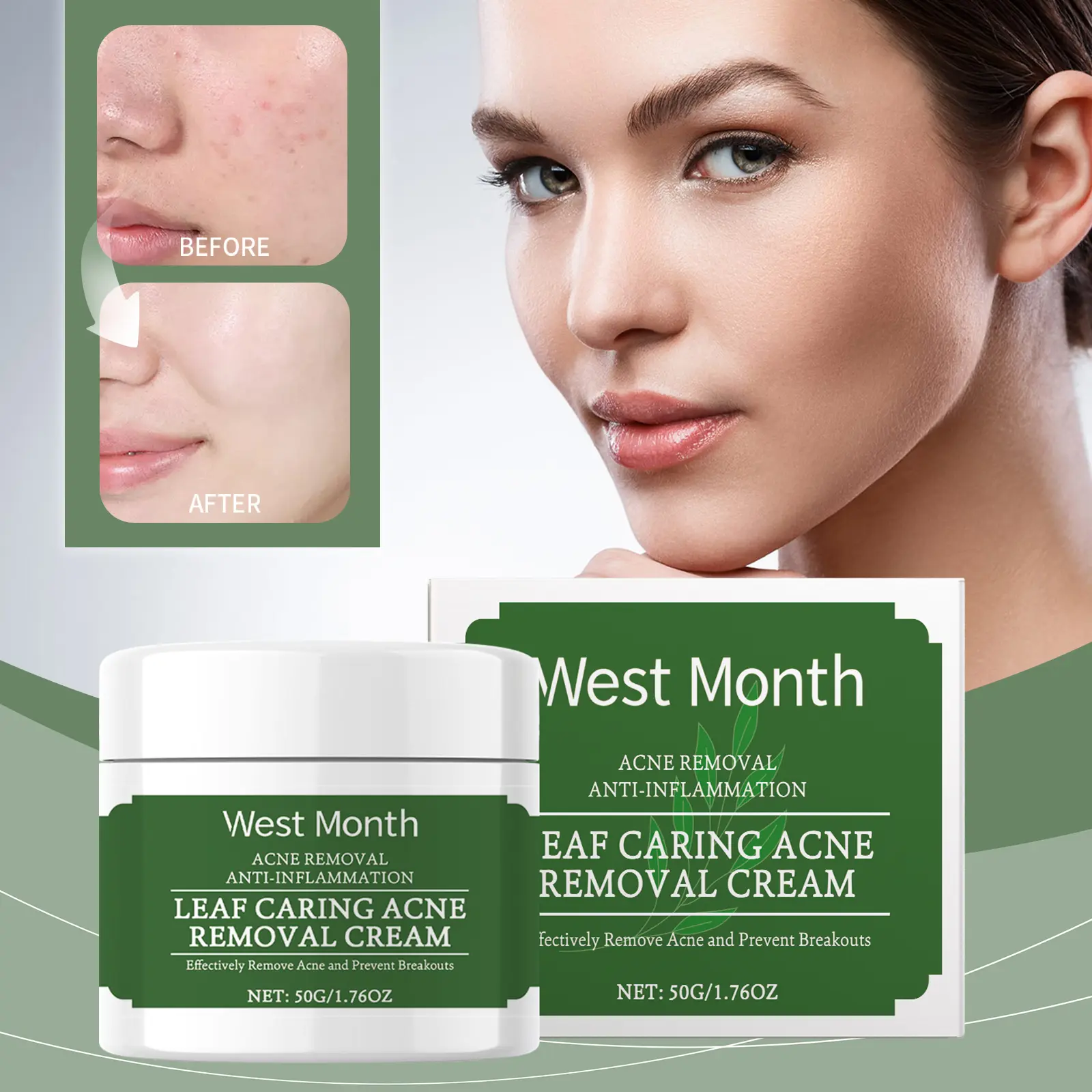 West&Month Soaning Acne Cream Review: My Messy Skincare Trial 2 Close up of a small amount of West&Month cream on a fingertip