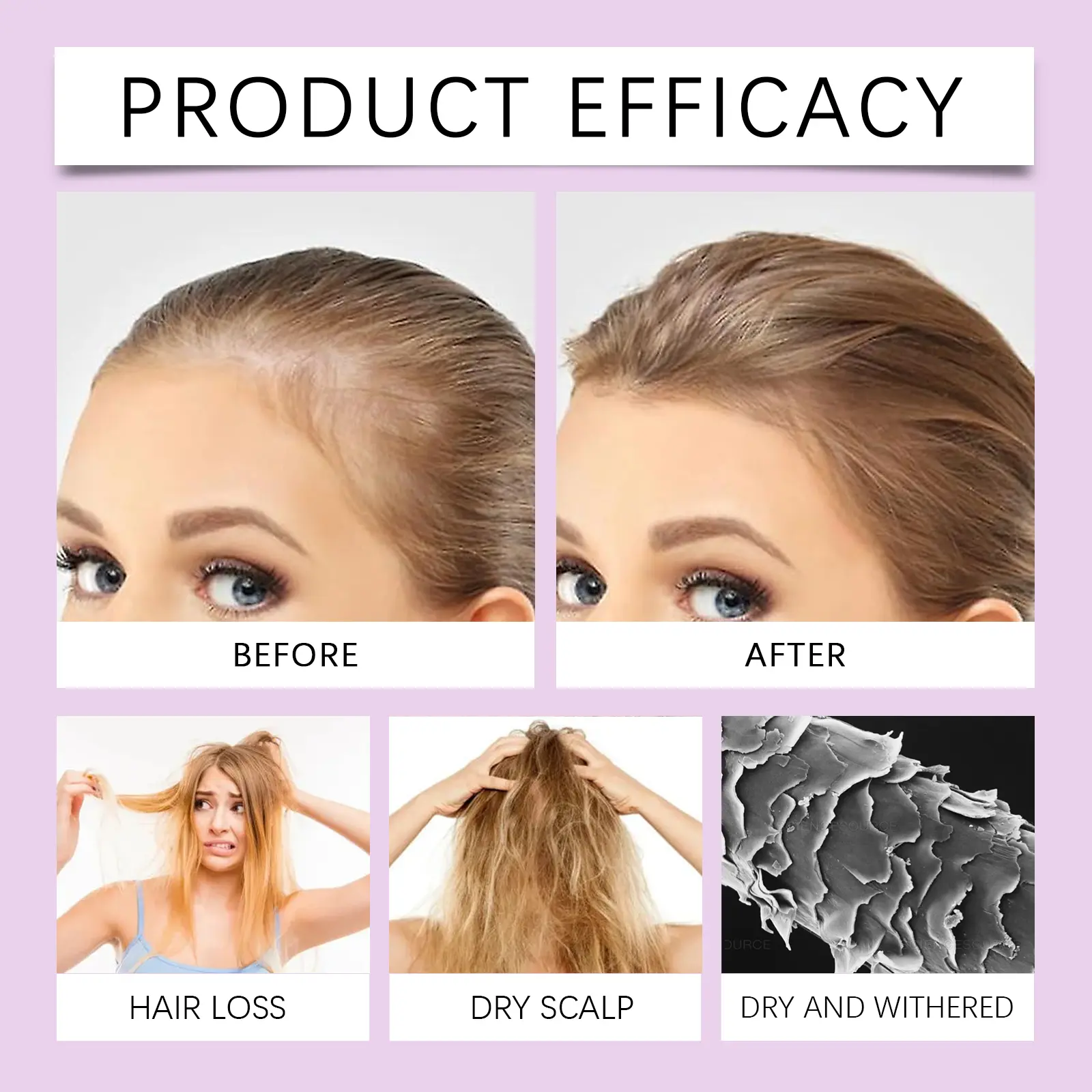 Soothing Scalp Essence Oil for Hair Nourishment - West&Month 9 soothing scalp essence nourish hair West Month 249 4256