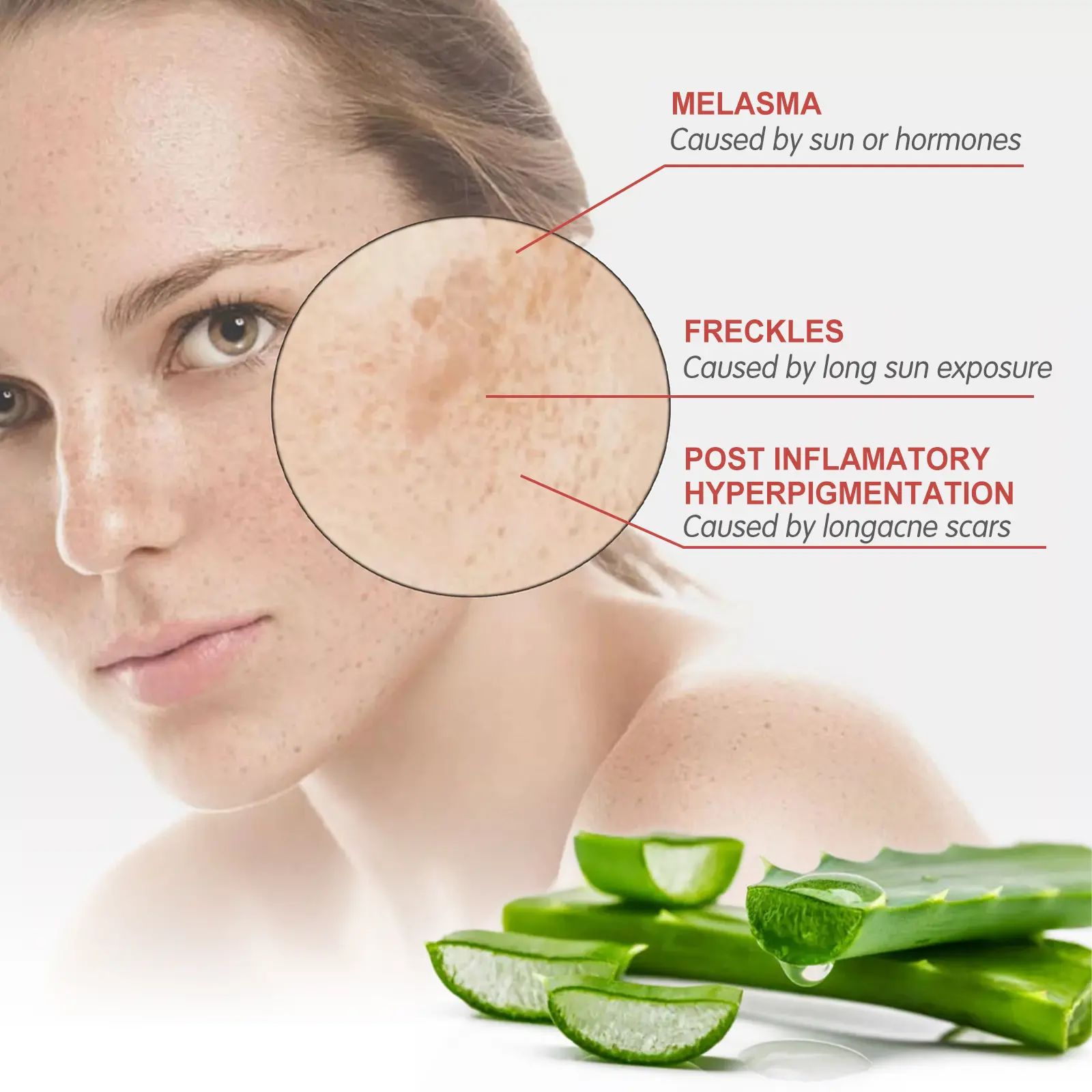 Speckle Corrector Cream for Dark Spots & Skin Brightening - West&Month 5 speckle corrector cream lighten repair hydrating West Month 346 5492