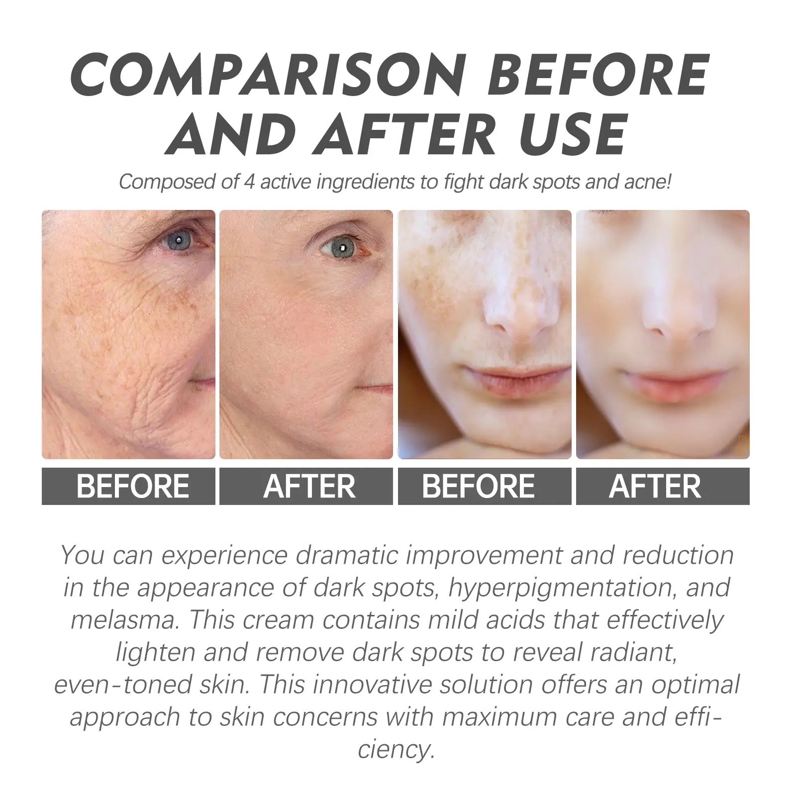 Speckle Corrector Cream for Dark Spots & Skin Brightening - West&Month 8 speckle corrector cream lighten repair hydrating West Month 346 5495
