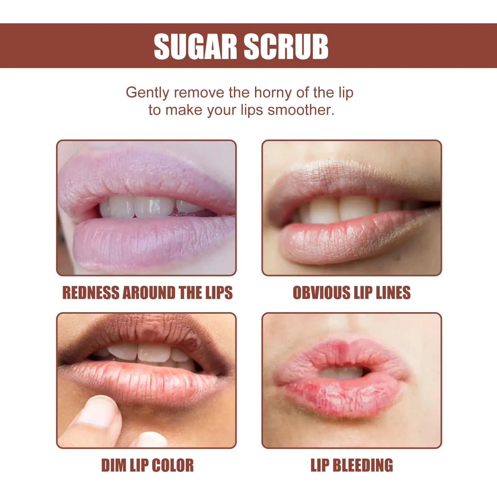 Sugar Scrub for Lips - Hydrating Exfoliating Care Cream by West&Month 6 sugar scrub fade lip lines cure peeling West Month 326 5217
