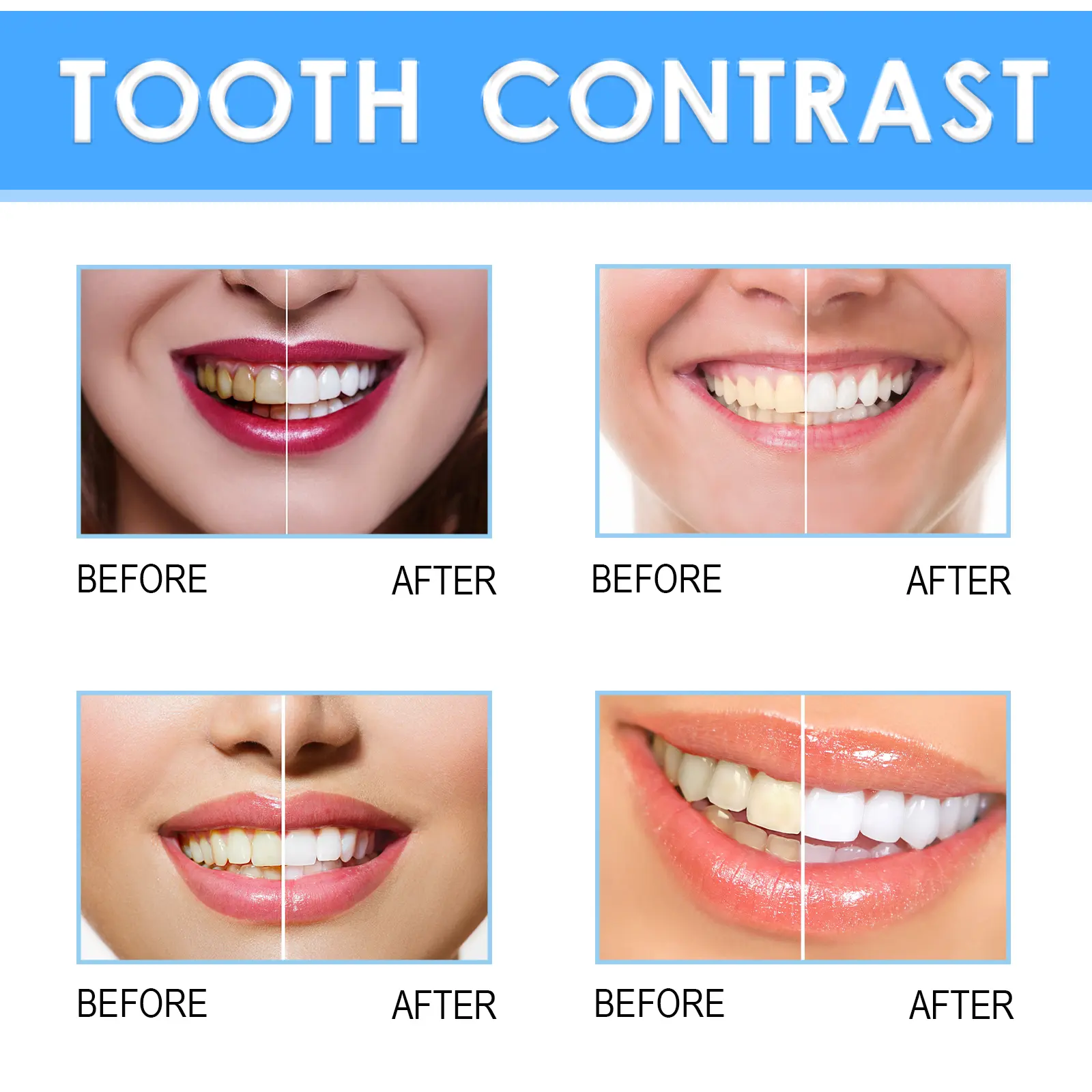 West&Month Teeth Whitening Gel Pen for Rapid Stain Removal 8 teeth brightening gel oral care clean white West Month 386 6053