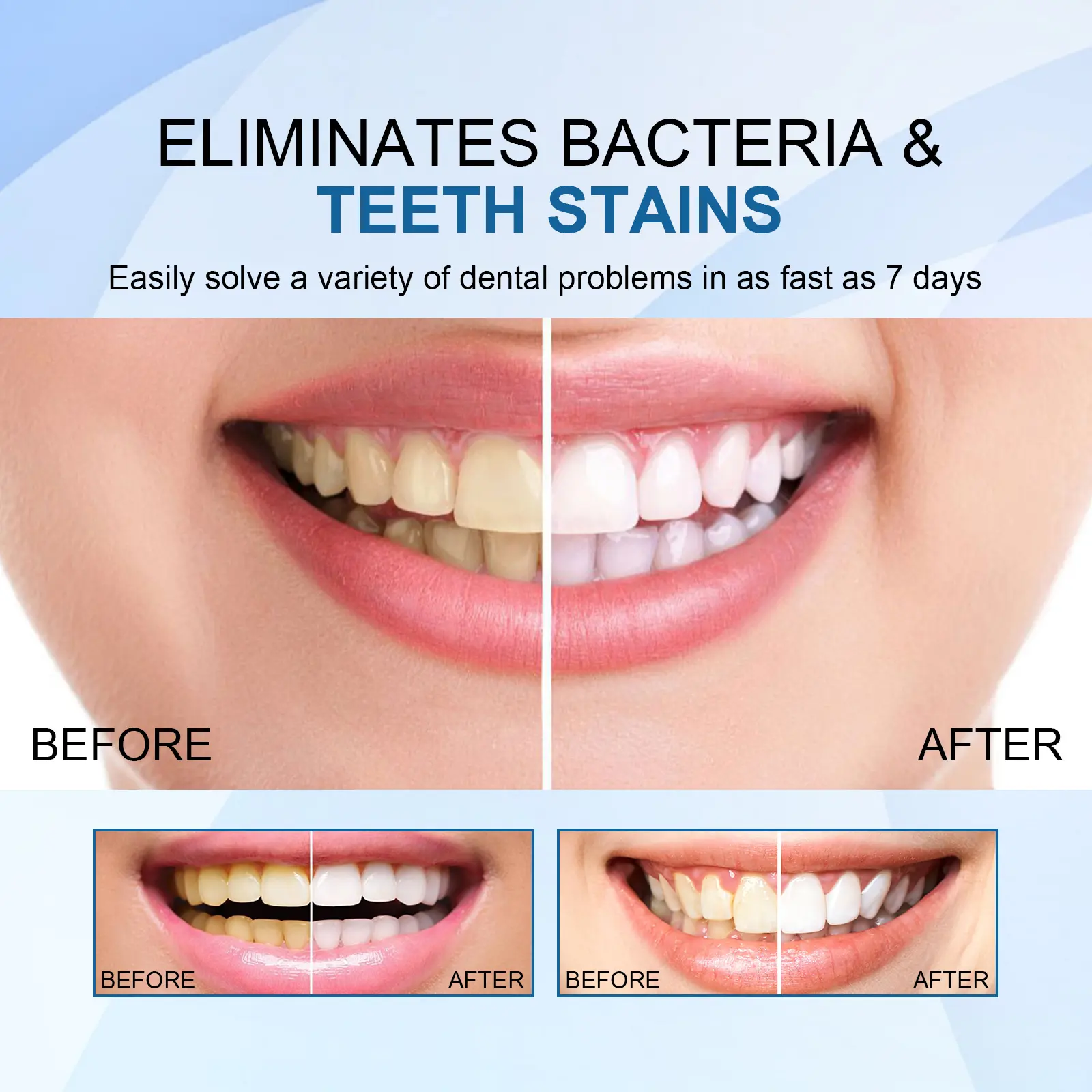 Teeth Whitening Essence Stain & Tartar Remover for Fresh Breath - West&Month 10 teeth whitening essence clean stains tartar West Month 129 2729