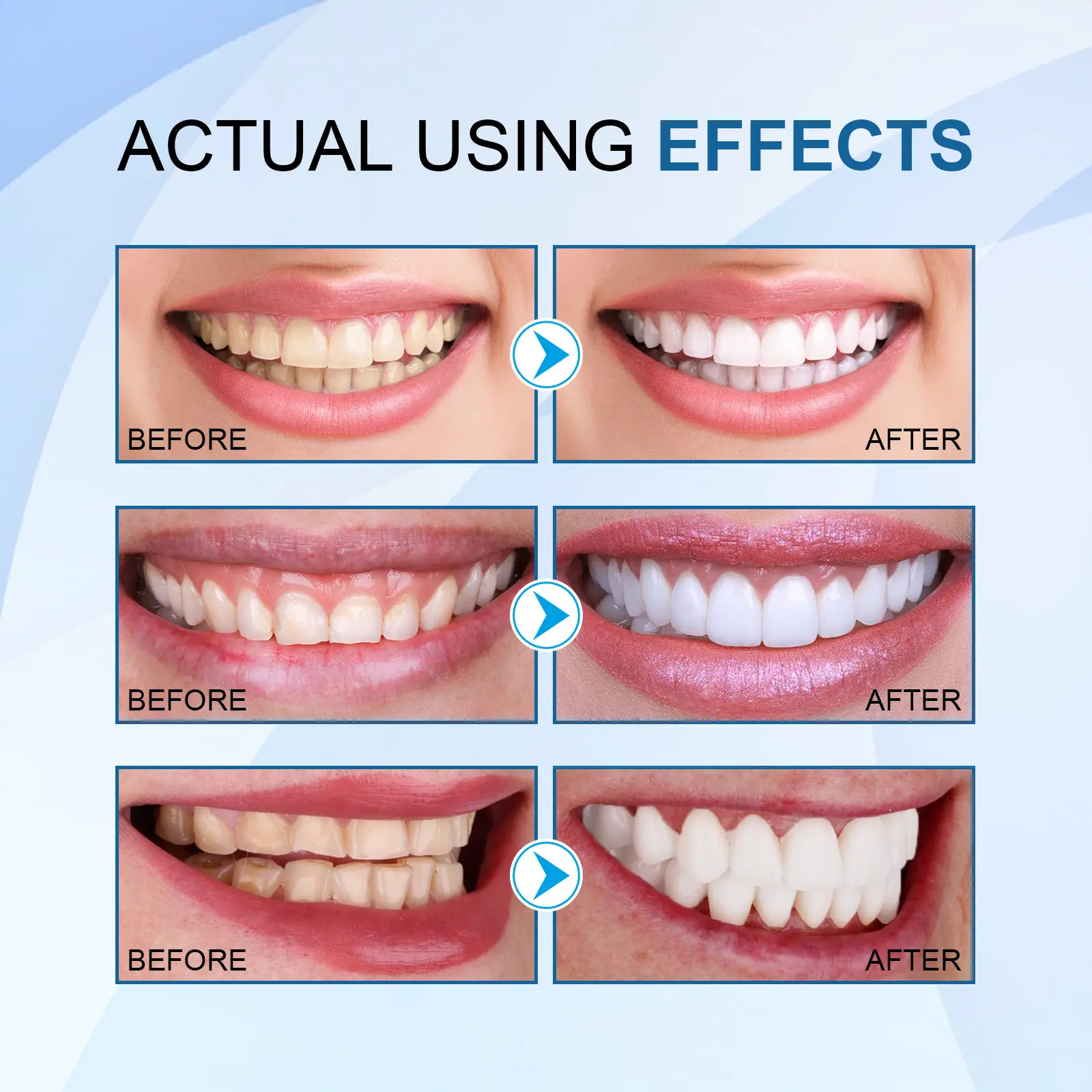 Teeth Whitening Essence Stain & Tartar Remover for Fresh Breath - West&Month 11 teeth whitening essence clean stains tartar West Month 129 2730