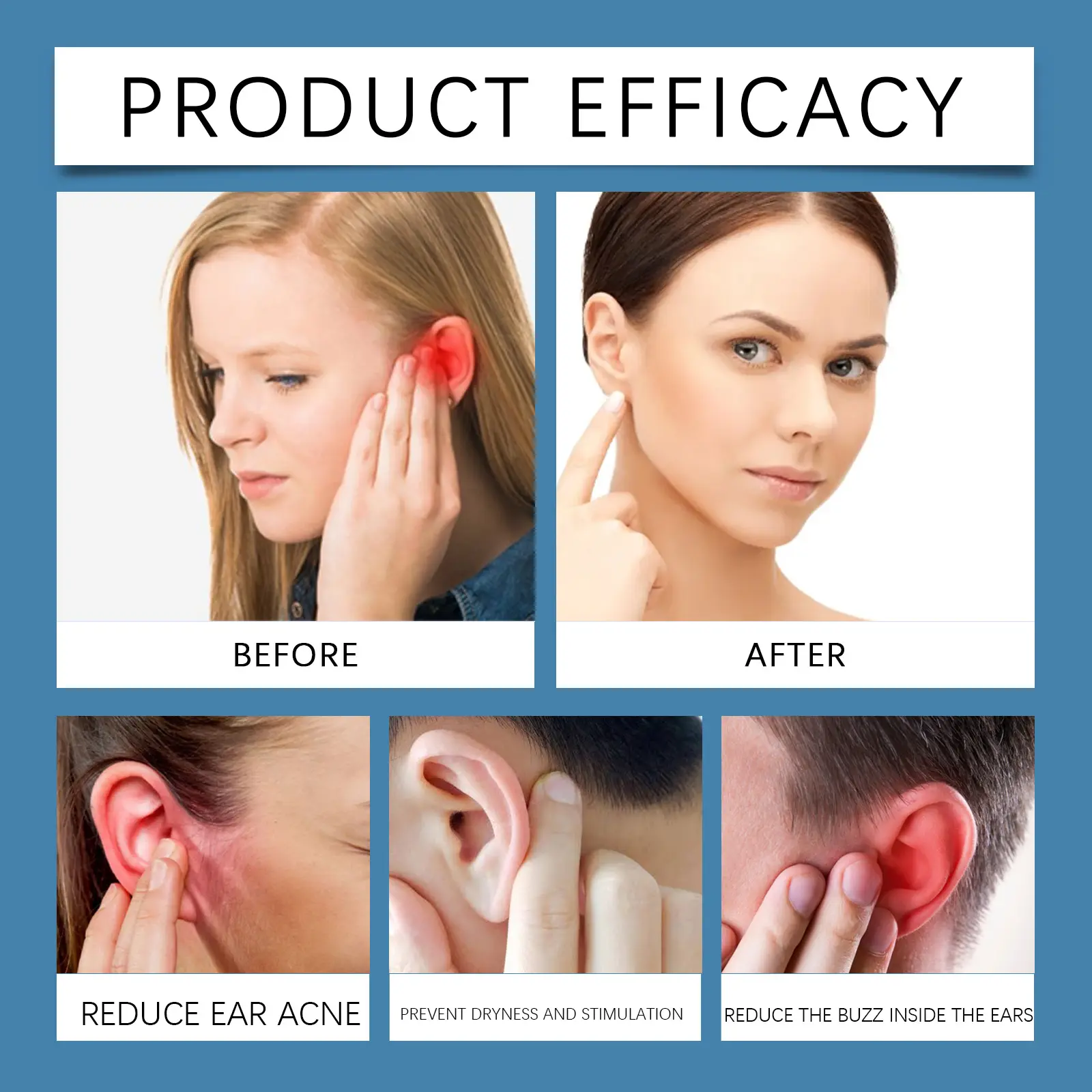 Tinnitus Serum Drops for Ear Itching and Acne - West&Month 9 tinnitus serum cochlear care repair itching West Month 115 2568