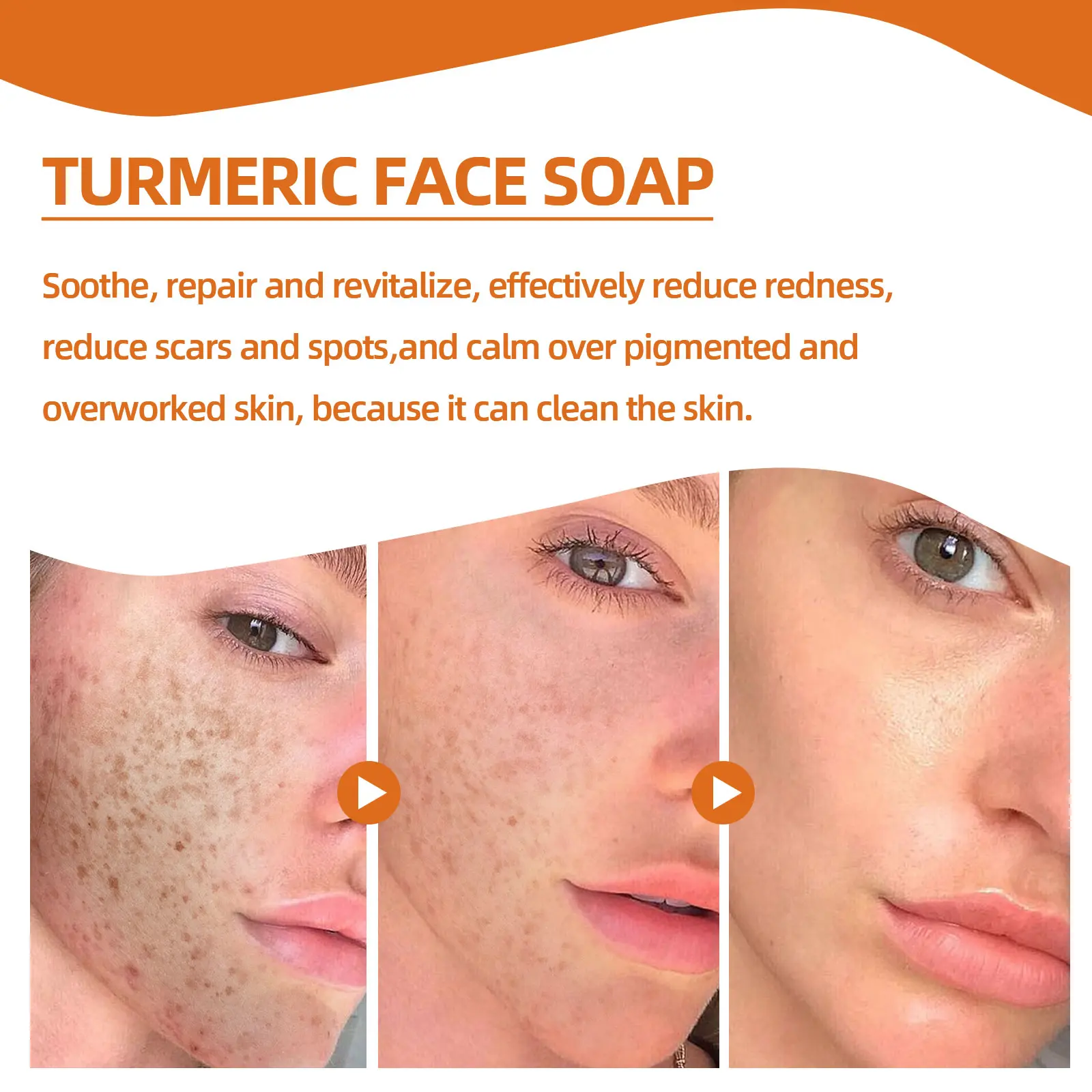 Turmeric Face Soap for Brighter Skin - West&Month 8 turmeric face soap repair fade spots West Month 011 1251