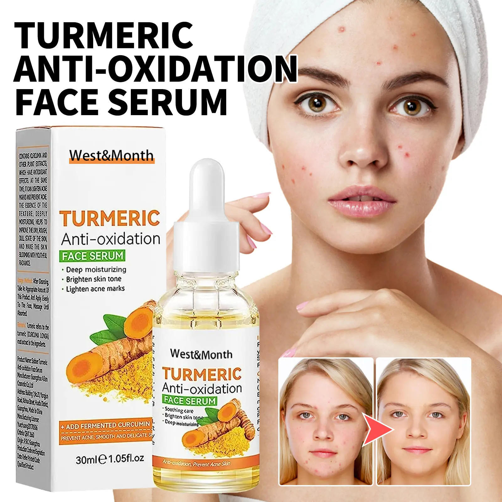 Turmeric Facial Essence for Brightening & Acne Marks - West&Month 1 turmeric facial essence lighten spots acne marks West Month 028 1459