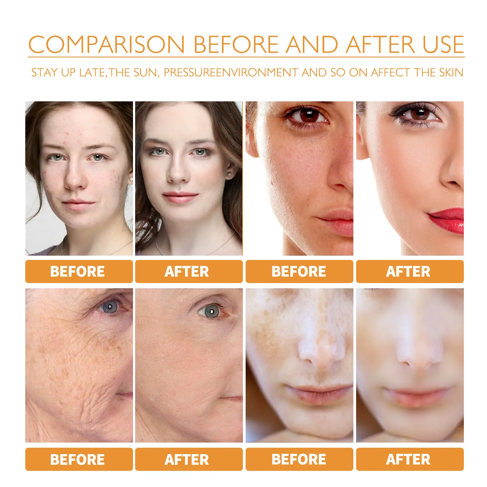 Turmeric Facial Essence for Brightening & Acne Marks - West&Month 8 turmeric facial essence lighten spots acne marks West Month 028 1466