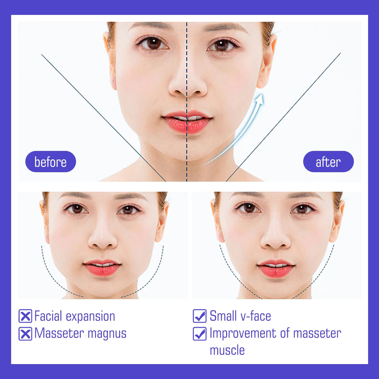 V-Shaped Face Stickers for Skin Firming and Chin Contouring - West&Month 8 v shaped face stickers firm slim lift West Month 269 4489