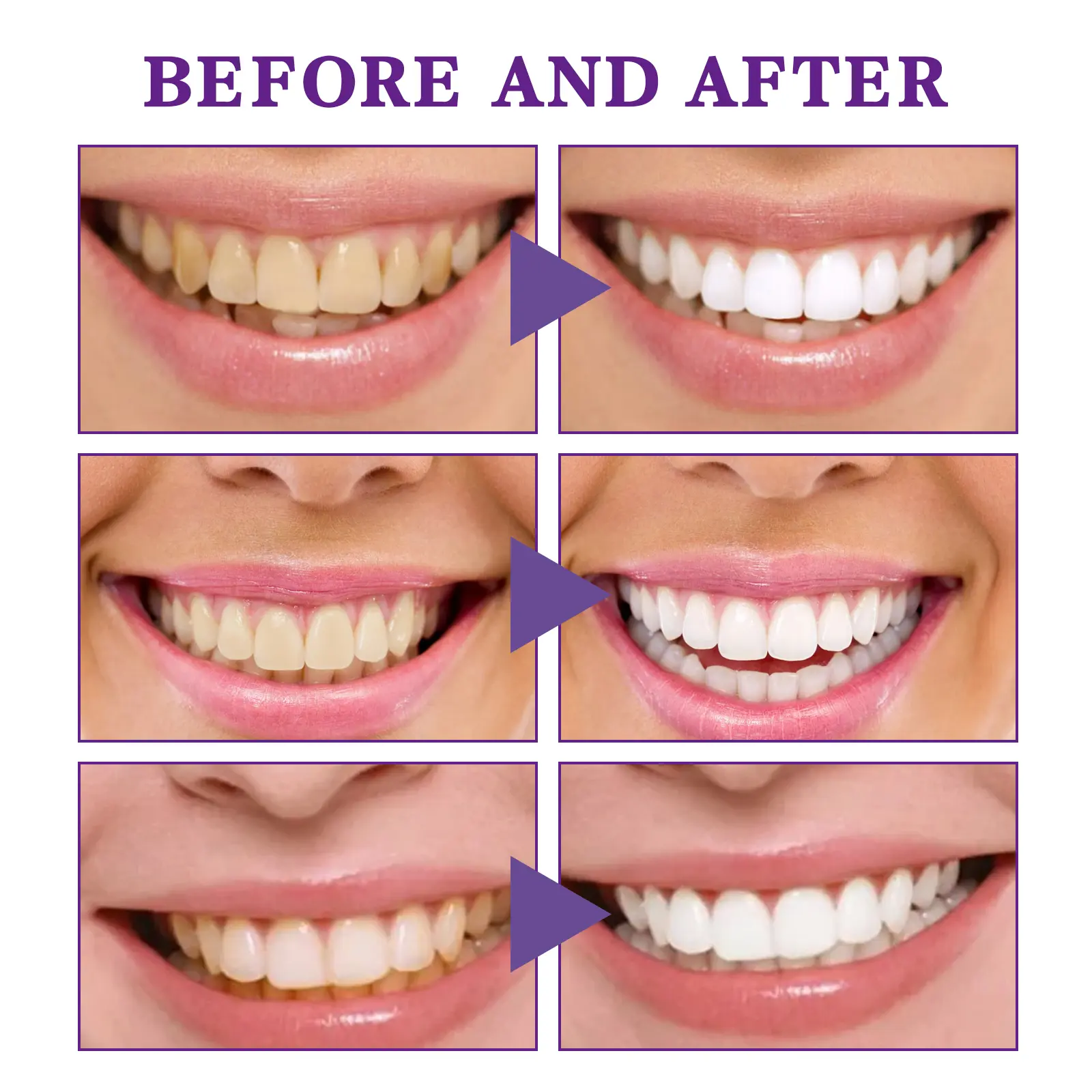 V34 Whitening Toothpaste for Teeth Brightening & Stain Removal - West&Month 9 v34 toothpaste whitening clean gums West Month 086 2187