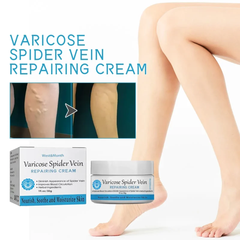 varicose vein cream relieve pain massage West Month 378 5928