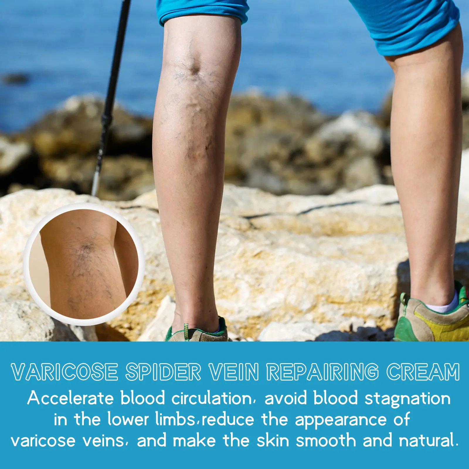 Varicose Vein Cream for Soothing Leg Massage Care - West&Month 4 varicose vein cream relieve pain massage West Month 378 5937