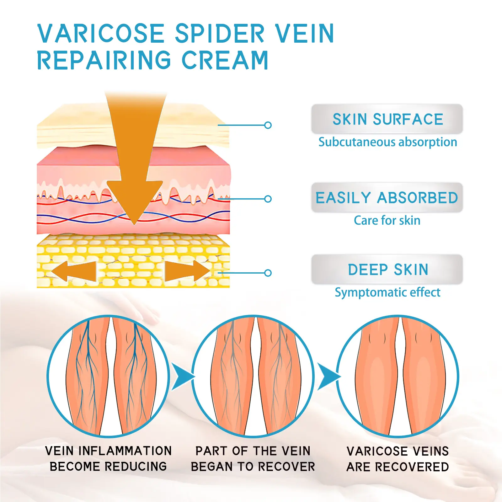 Varicose Vein Cream for Soothing Leg Massage Care - West&Month 5 varicose vein cream relieve pain massage West Month 378 5938