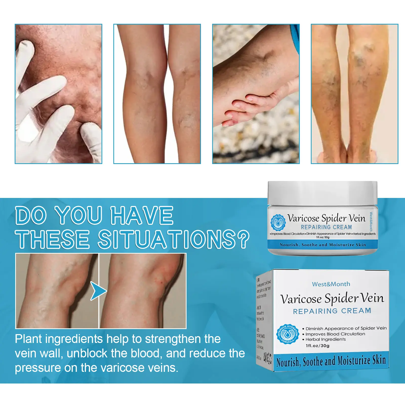 Varicose Vein Cream for Soothing Leg Massage Care - West&Month 6 varicose vein cream relieve pain massage West Month 378 5939