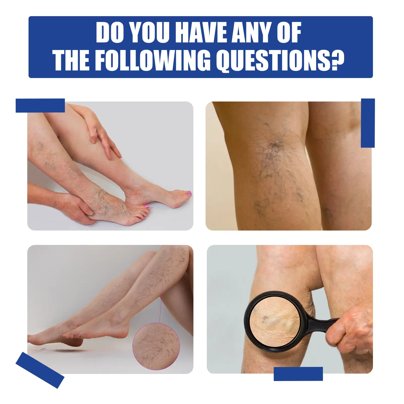Varicose Vein Support Spray for Leg Wellness and Skin Comfort - West 5 varicose vein spray relieve bulge repair West Month 398 6222
