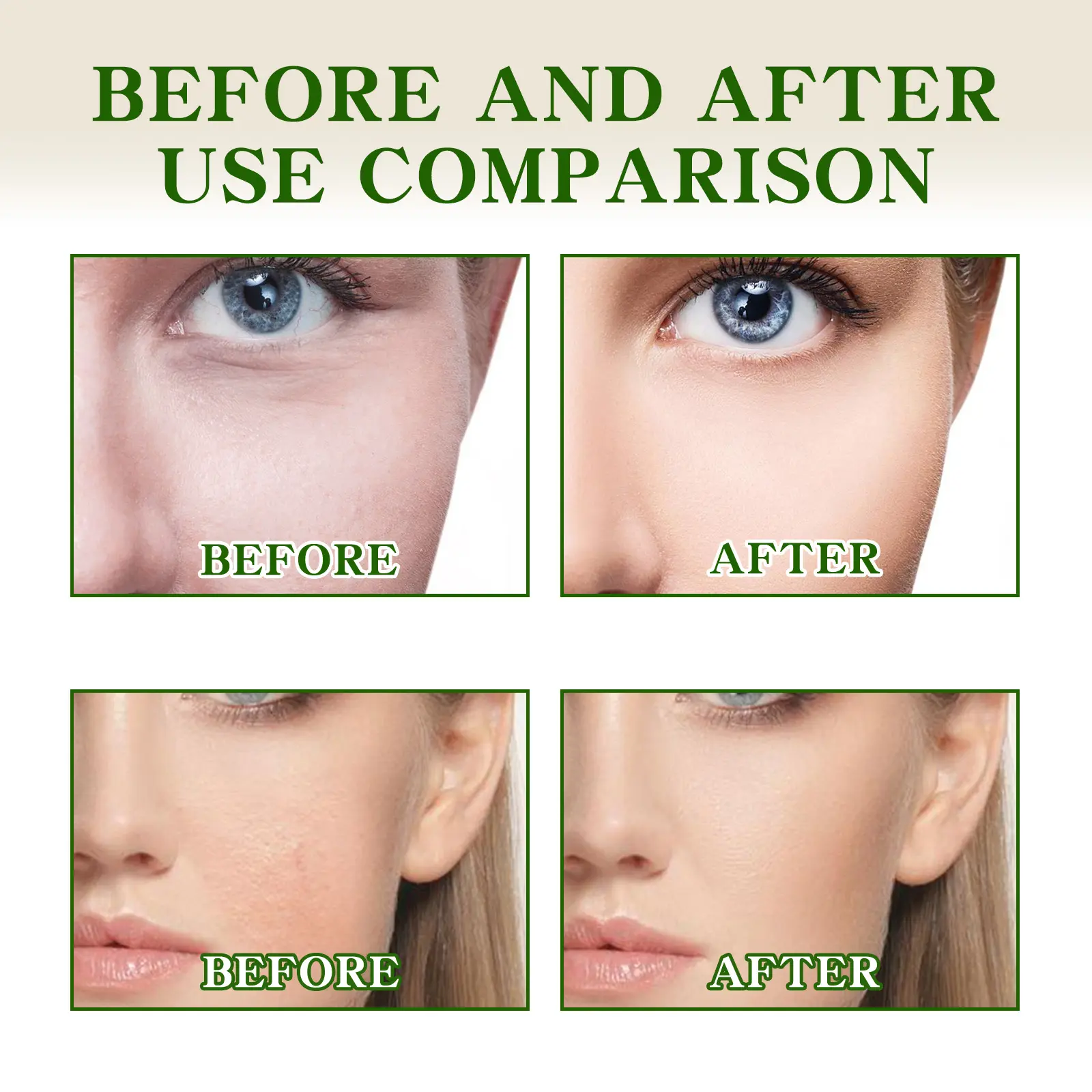 Vitamin C Dark Spot Serum Brightening Moisturizing Essence West&Month 8 vitamin c dark spot serum moisturize brighten West Month 364 5751