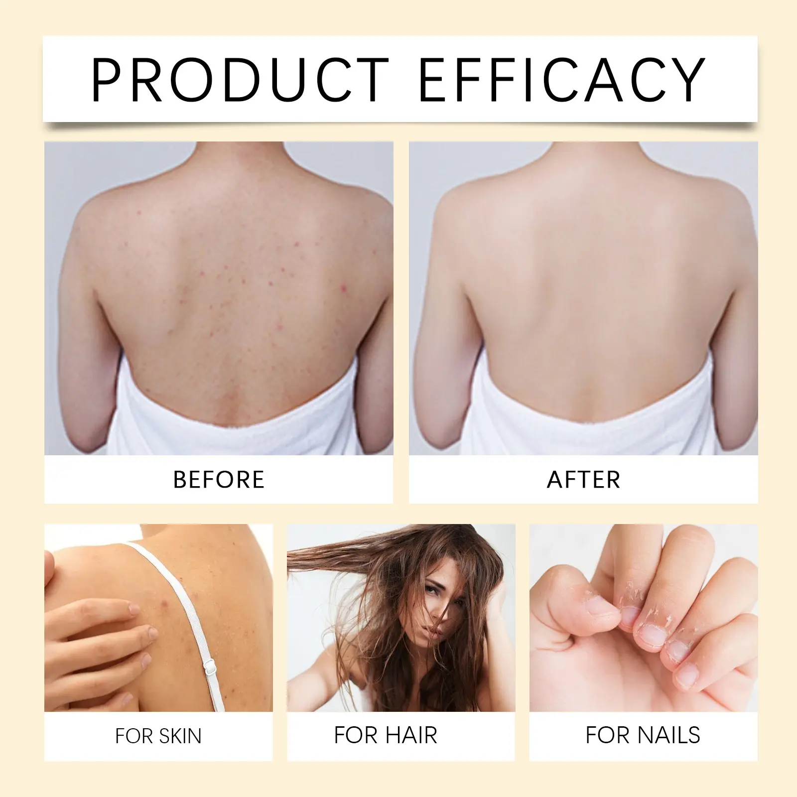 Vitamin E Body Oil for Hair, Skin & Nails - Nourishing Multi-Use Care - West&Month 9 vitamin e body oil nourish hair nails skin West Month 065 1921