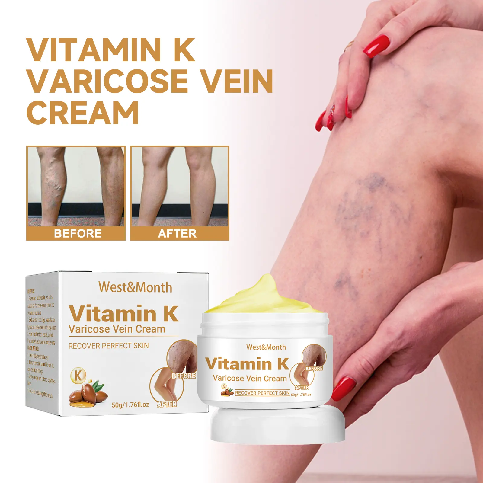 Vitamin K Varicose Vein Cream for Soothing Leg Relief - West&Month 1 vitamin k varicose vein cream West Month 186 3442