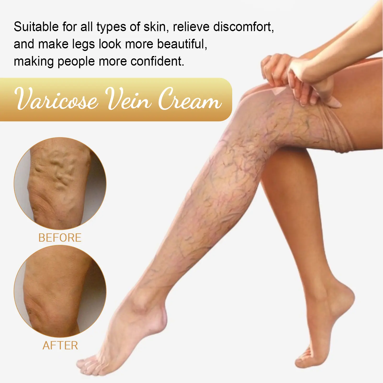 Vitamin K Varicose Vein Cream for Soothing Leg Relief - West&Month 4 vitamin k varicose vein cream West Month 186 3445