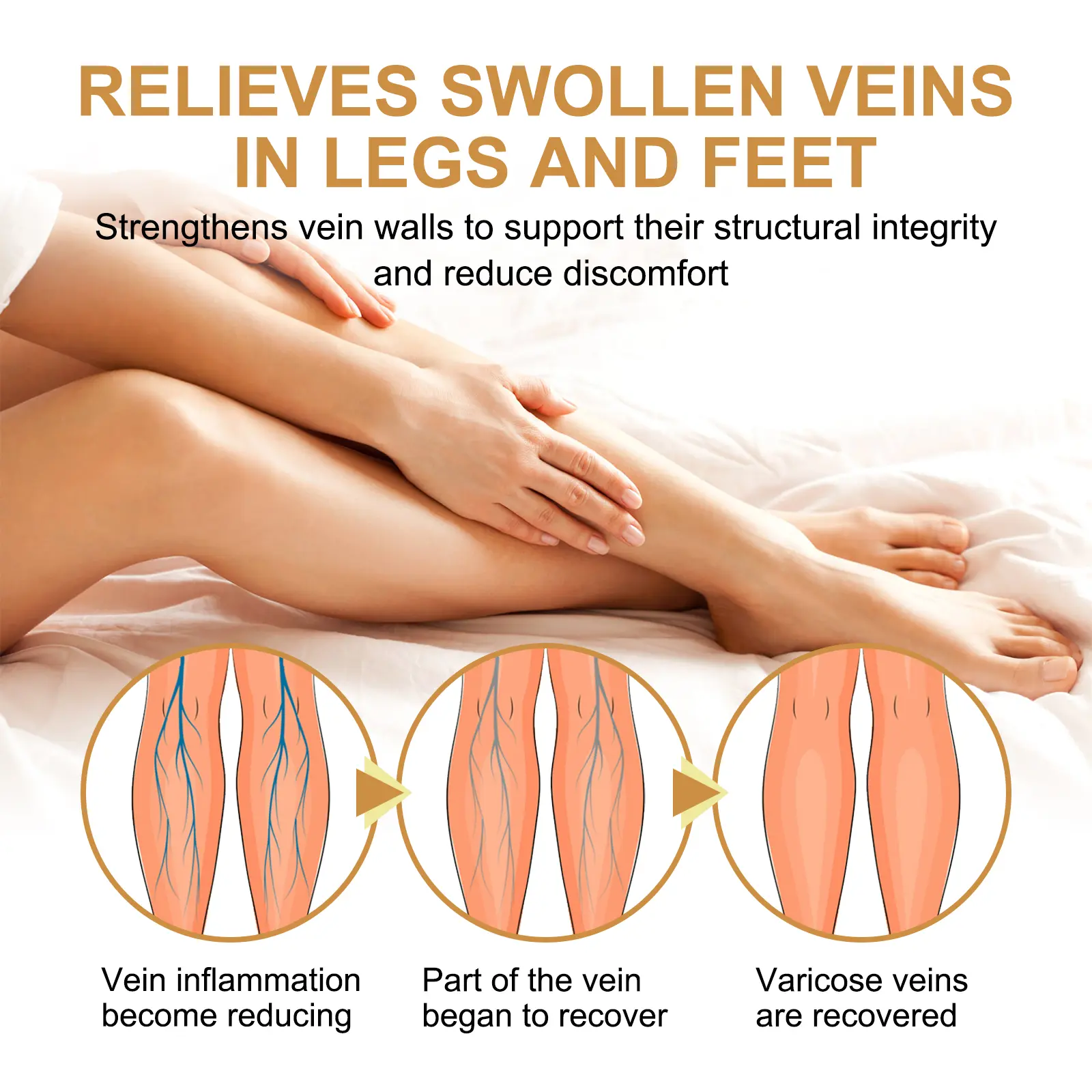 Vitamin K Varicose Vein Cream for Soothing Leg Relief - West&Month 5 vitamin k varicose vein cream West Month 186 3446