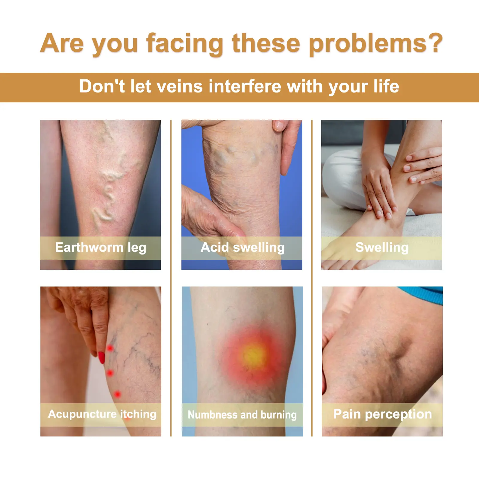 Vitamin K Varicose Vein Cream for Soothing Leg Relief - West&Month 6 vitamin k varicose vein cream West Month 186 3447
