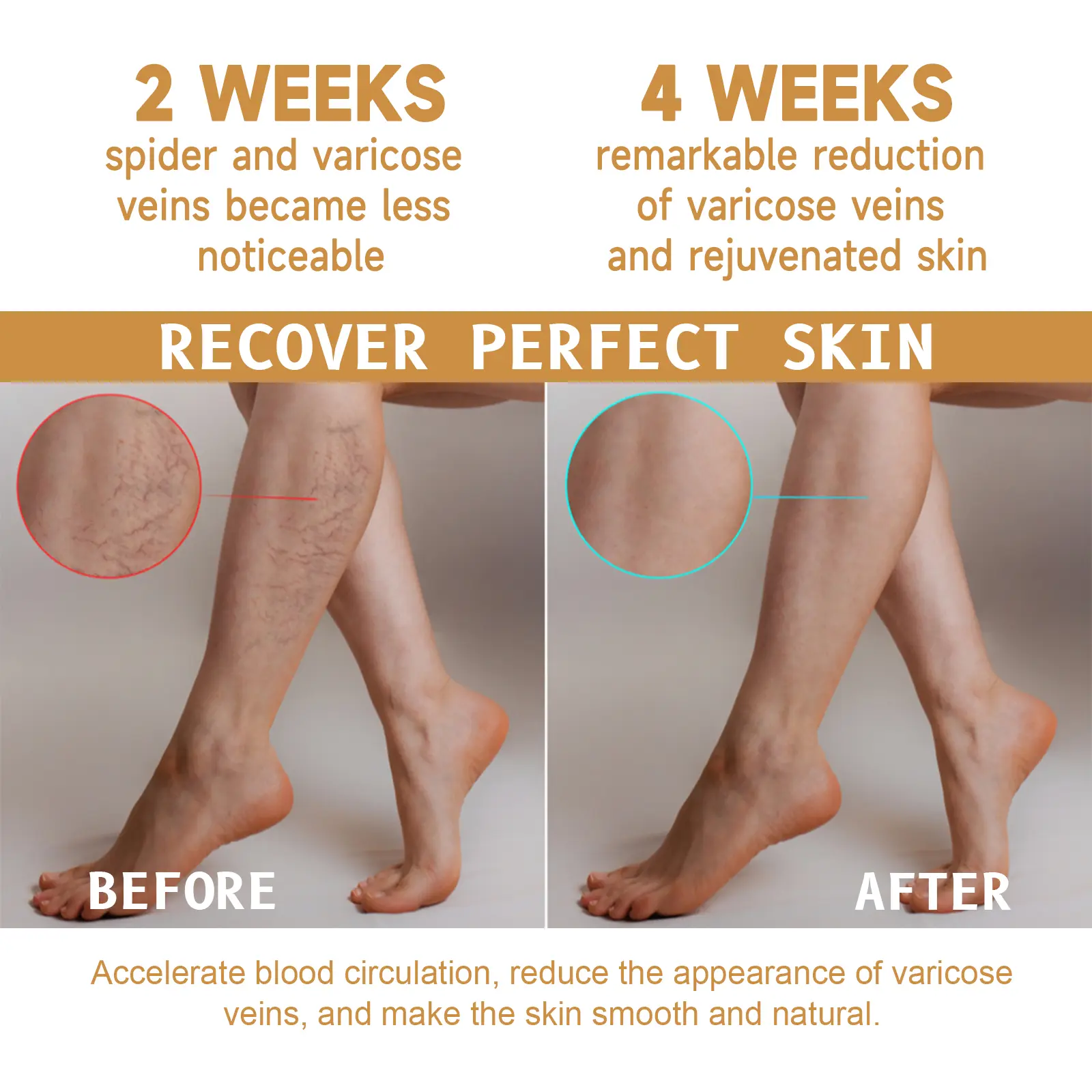 Vitamin K Varicose Vein Cream for Soothing Leg Relief - West&Month 7 vitamin k varicose vein cream West Month 186 3448