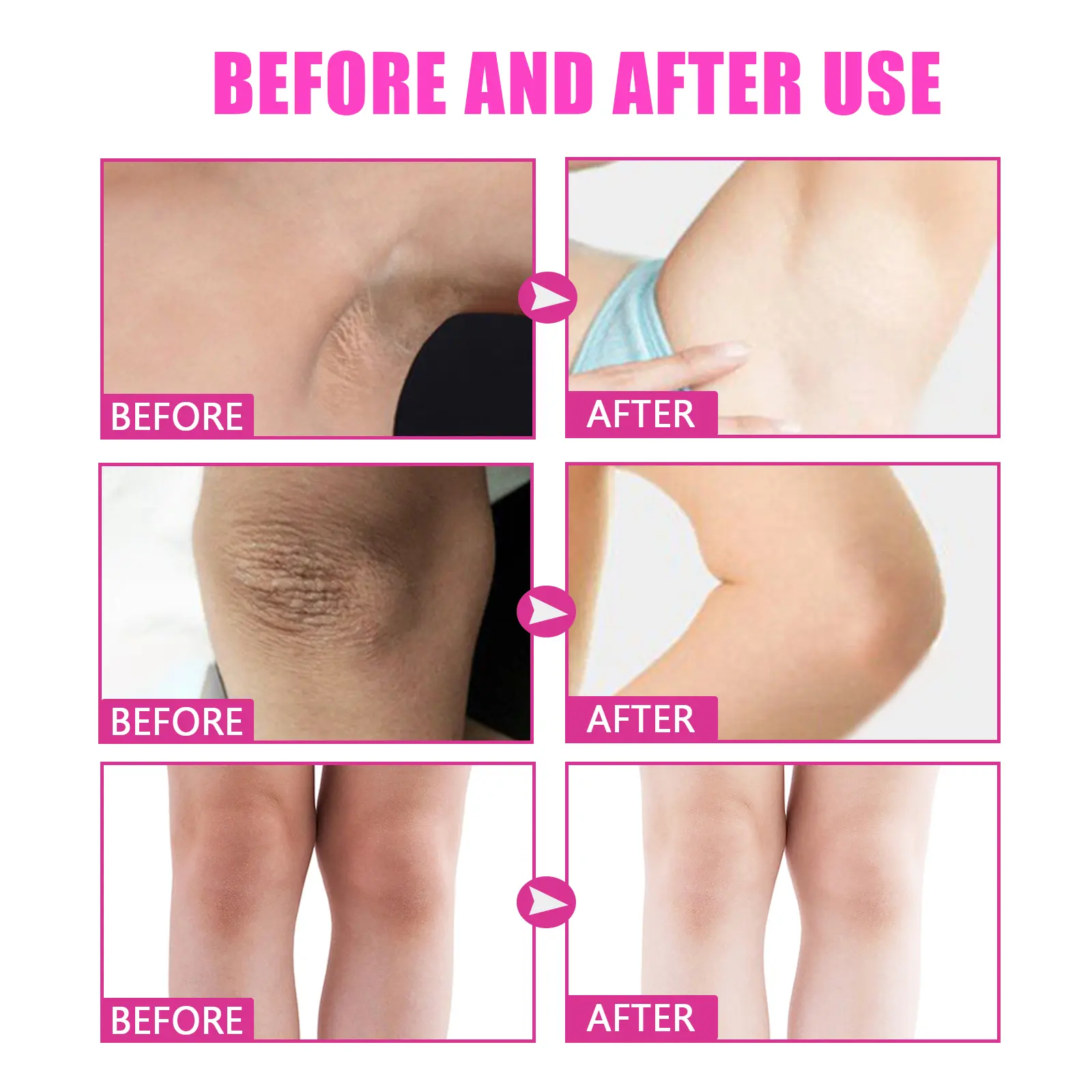 Skin Whitening Cream for Dark Spots & Brightening - West&Month 7 whitening cream brighten moisturize remove black West Month 323 5177