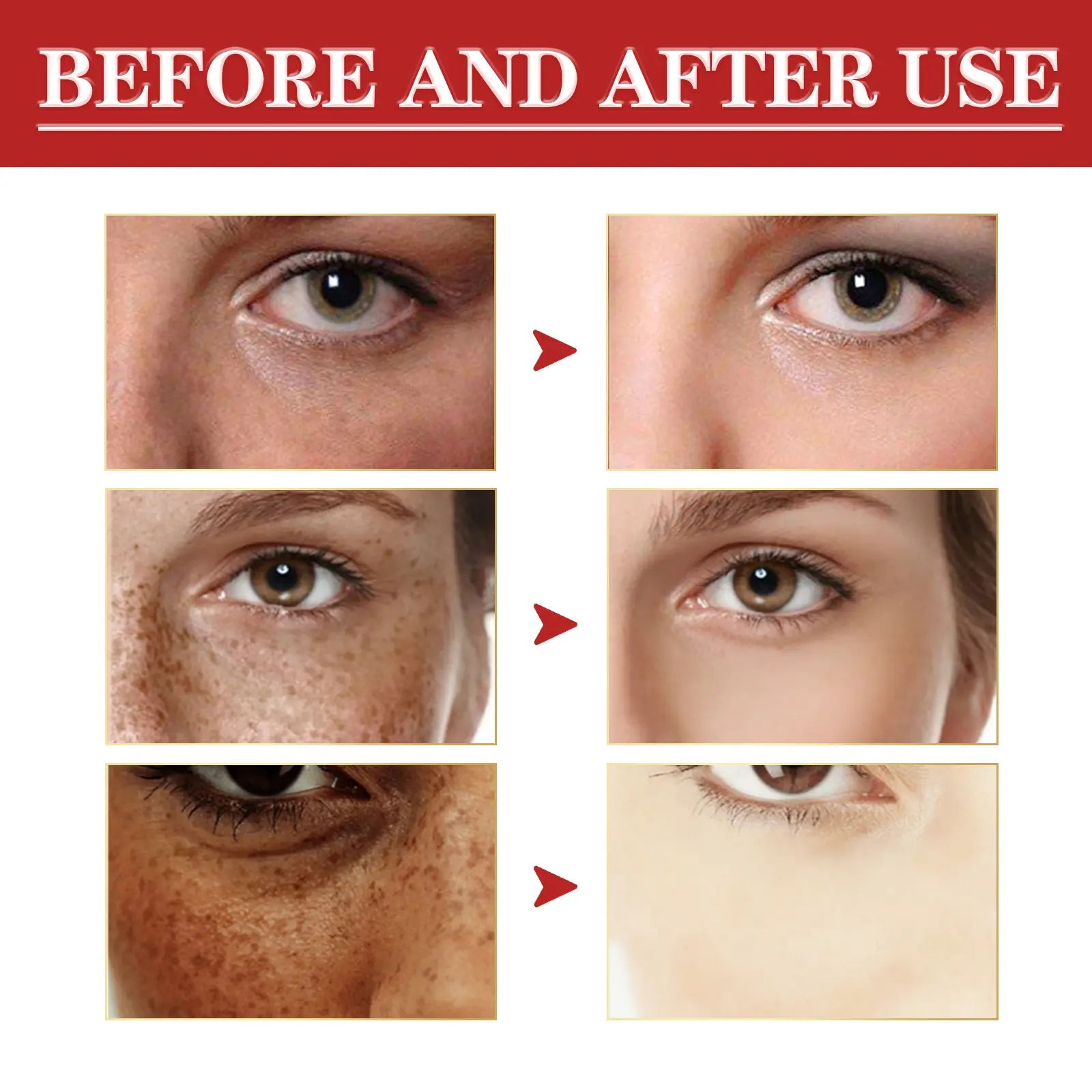 Brightening Cream for Dark Spots & Fine Lines - West&Month 7 whitening freckle cream restore reduce spots West Month 227 3966